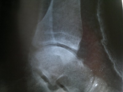 28042011636.jpg